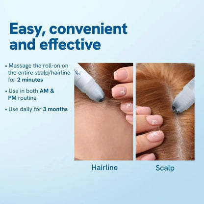 Hair Ball Essence Rosemary Growth Oil